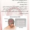 EEG